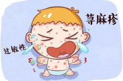 白癜风自愈率低的主要原因