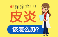 神经性皮炎有哪些正确预防措施